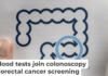 Screening is essential to prevent and effectively treat colorectal cancer. Varlay/iStock via Getty Images Plus